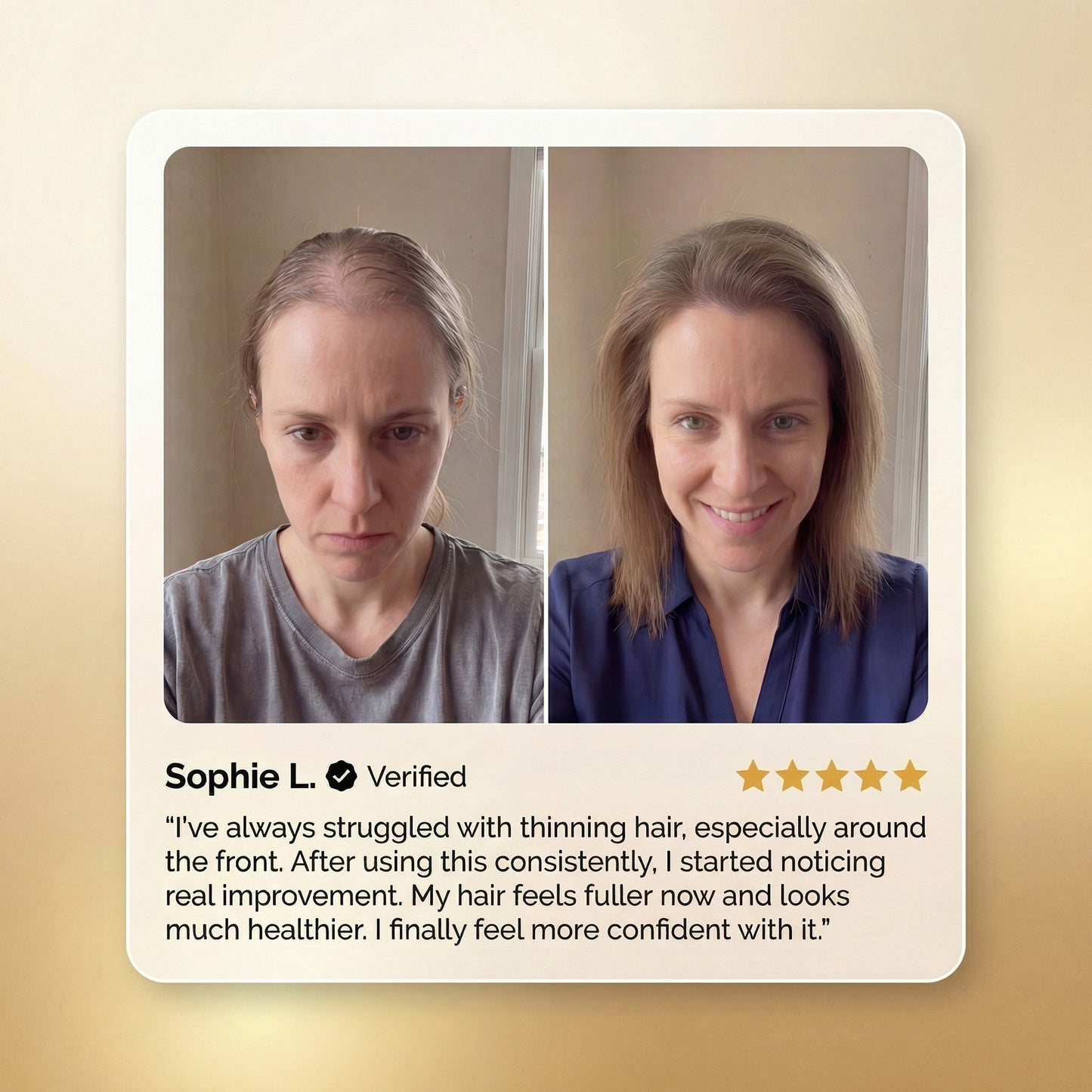 ROSERUNE™ Advanced Batana Hair Regrowth Therapy