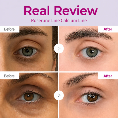 🔥LAST DAY 50% OFF!!ROSERUNE Calcium Dark Spot Eye Cream