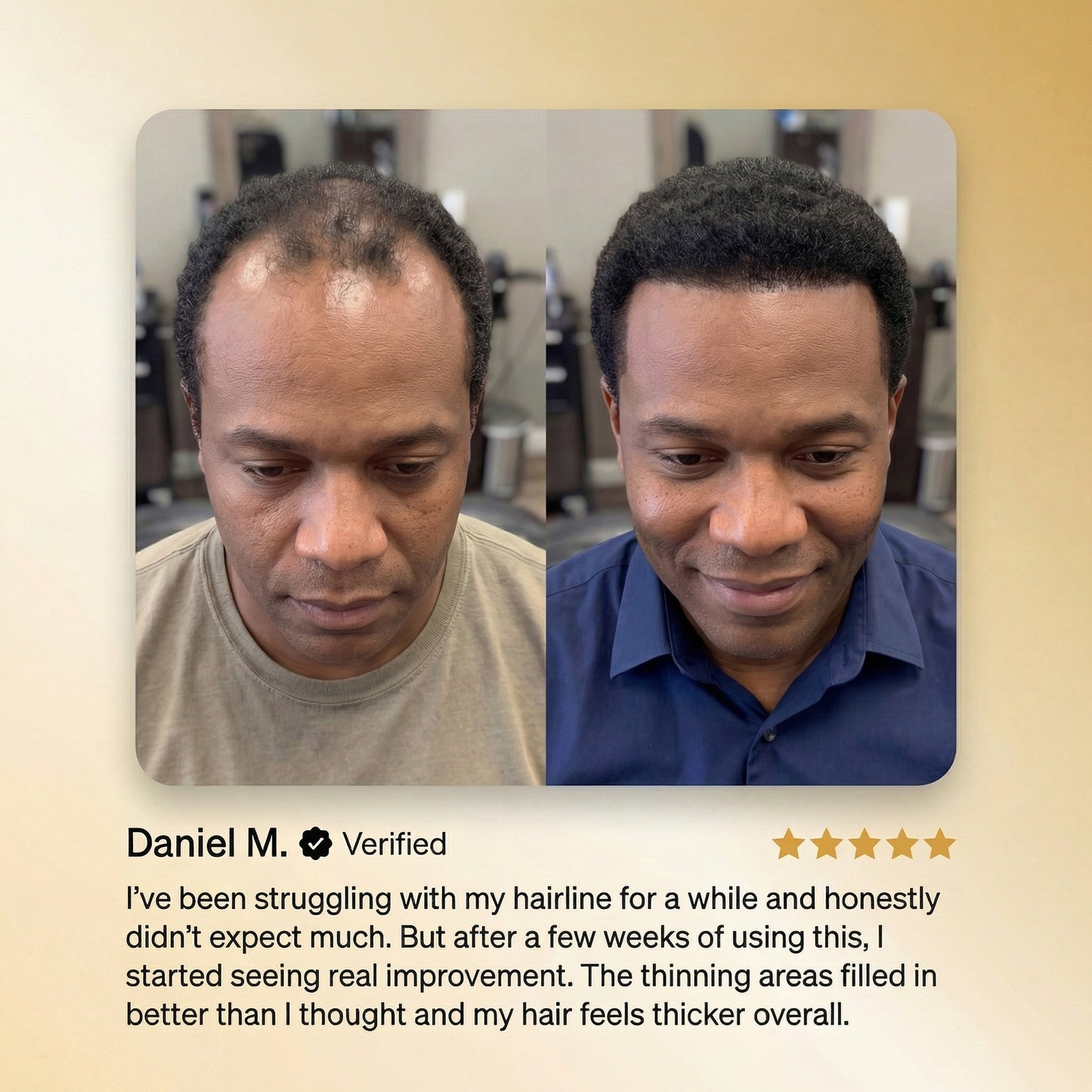 ROSERUNE™ Advanced Batana Hair Regrowth Therapy