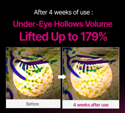 🔥LAST DAY 50% OFF!!ROSERUNE Calcium Dark Spot Eye Cream